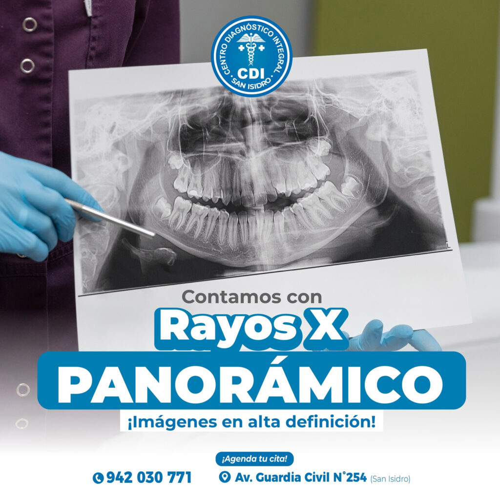 La radiografía panorámica proporciona al dentista una vista bidimensional de oreja a oreja de la mandíbula superior e inferior.
